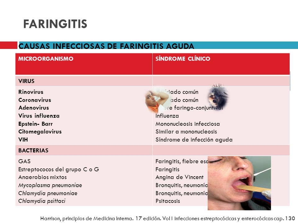 Causas de la faringitis bacteriana